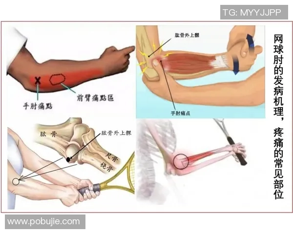广州网球队区域防守策略解析与深度剖析网球战术的创新与应用